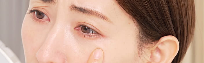 目元のしわイメージ