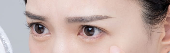 目周りの凹みイメージ