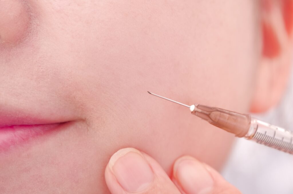 記事アイキャッチ画像