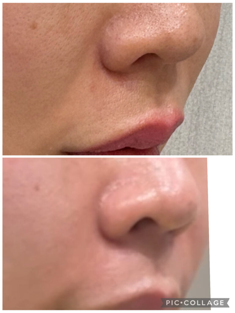 記事アイキャッチ画像