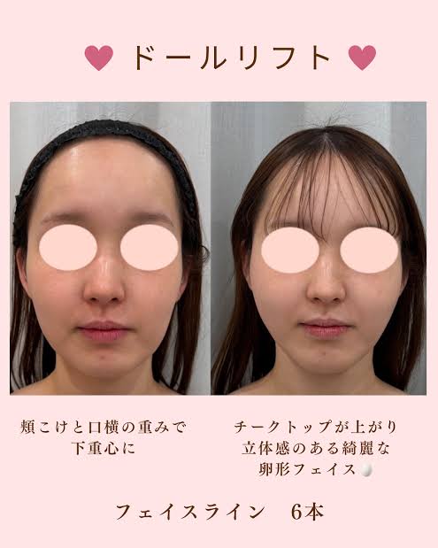 記事アイキャッチ画像