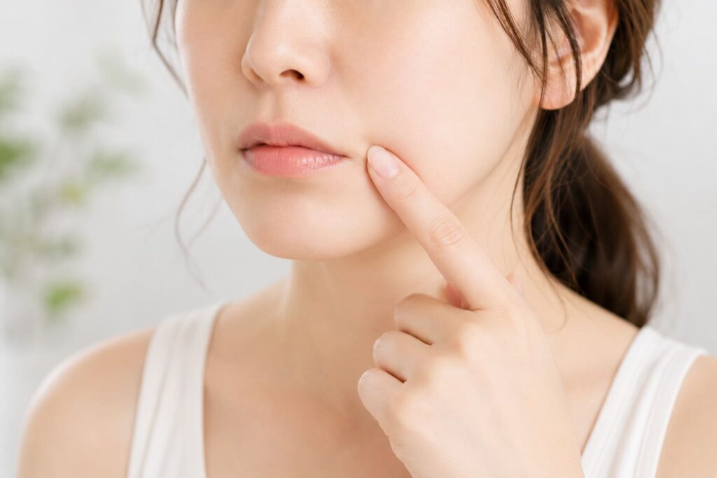 口横のポニョはなぜできる？原因・セルフケア・美容医療を解説